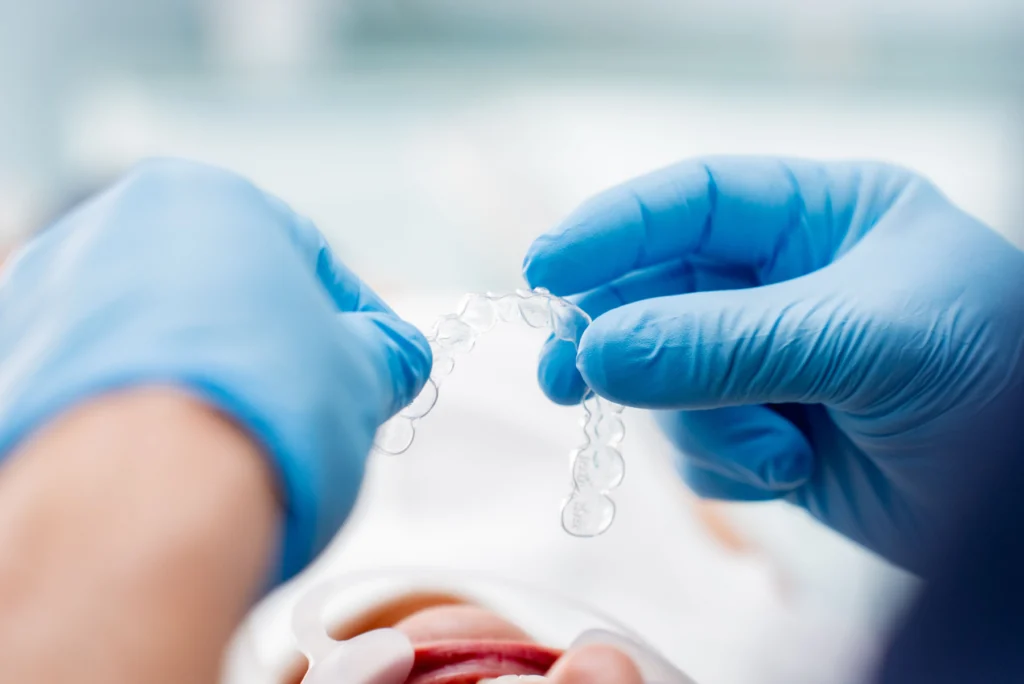 Orthodontiste adulte Gaillard, près de Genève