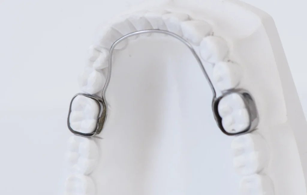 Orthodontiste arc lingual Gaillard, près de Genève