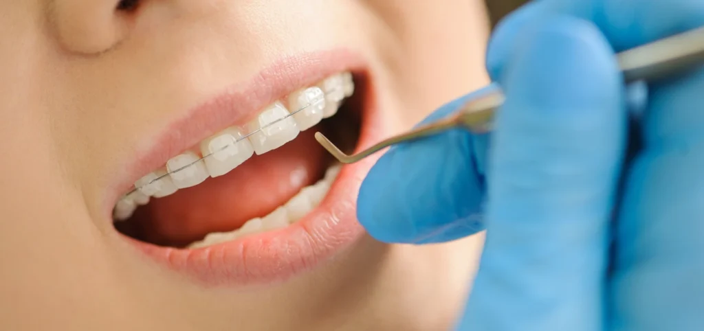 Orthodontiste adolescent Gaillard, près de Genève