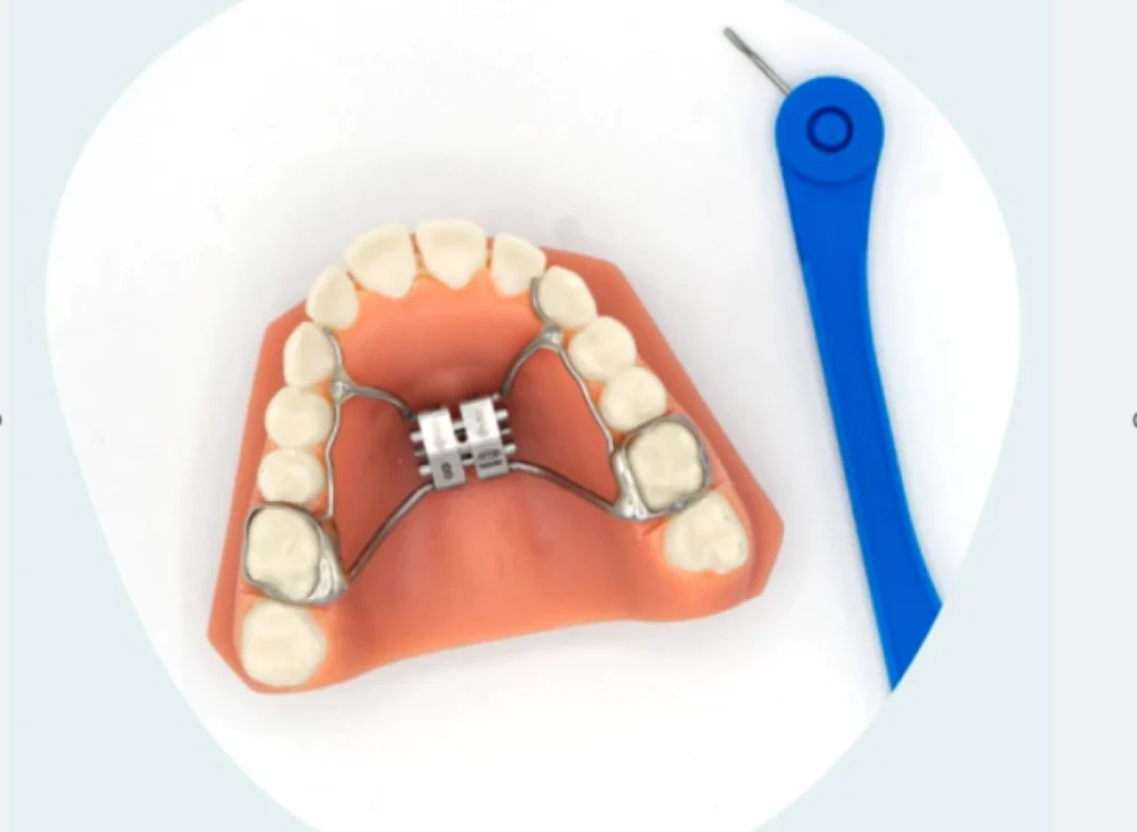 Disjoncteur Orthodontiste Gaillard, près de Genève